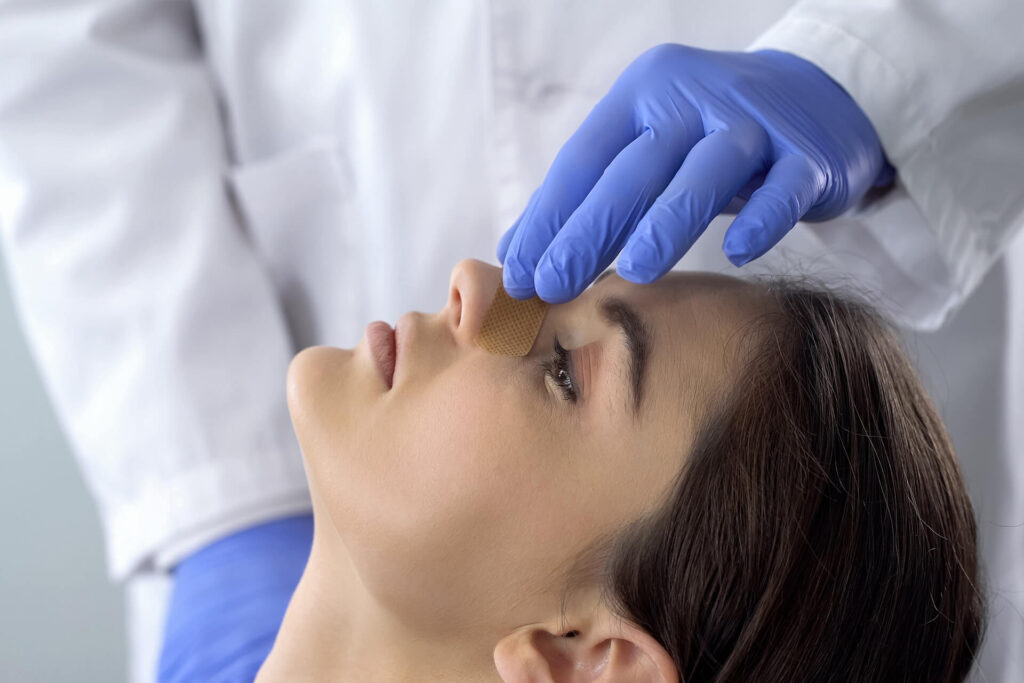 Rinoplastia